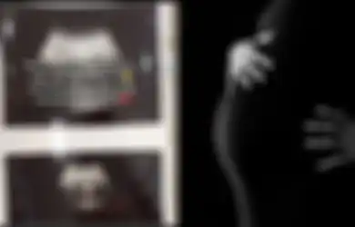 Viral Kisah Ibu Hamil Kehilangan Janin dalam Kandungan usai Tolong Nenek-nenek saat Magrib, Warganet Singgung Sosok Hantu Palasik