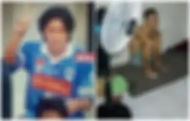 Hidung Pecah dan Mata Sedikit Buta, Begini Kondisi Eks Pemain PSIS Semarang yang Memprihatinkan, Tubuhnya Digerogoti Penyakit Serius