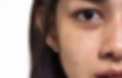 Ini 5 Penyebab Kulit Jadi Kusam Cuma dalam Semalam, Kok Bisa?