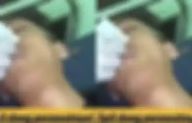 Viral Perawat Cewek Cengengesan saat Urus Pasien Korban Kecelakaan, Kepala Puskesmas Minta Maaf: Kami Berikan Sanksi