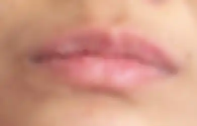Sering Mencabut Kulit Bibir yang Kering? Awas 4 Bahaya Ini Mengintai!