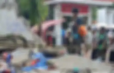 Ibunya Tewas Saat Pasang Badan Lindungi Tubuhnya, Begini Kondisi Bocah 10 Tahun yang Berhasil Selamat dari Tembok SPBU Roboh di Tebet