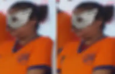 Disuruh Kumur Air Panas hingga Ditusuk Gunting, Kejamnya Ibu di Surabaya yang Melakukan Penyiksaan Bertubi-tubi pada Anak Kandung