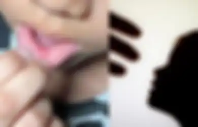 Bibir 36 Siswa SD Ditusuk Guru dengan Peniti, Bermula dari Masalah Sepele