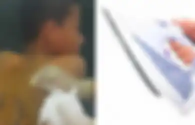 Punggung Anaknya Disetrika Oknum Pembina Pondok Tahfiz di Parepare, Ayah Menangis di Kantor Polisi: Penyiksaan Zaman Perang