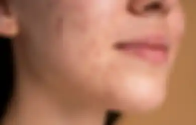 5 Cara Pakai Skincare yang Bisa Bikin Wajah Jadi Breakout. Hindari Ya!