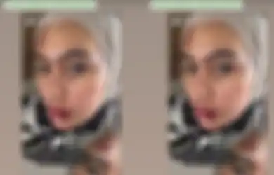 Mulut Melepuh, Kartika Putri Sindir Oknum yang Jadikan Penyakitnya Bahan Pansos, Istri Habib Usman Singgung Dosa