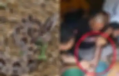Ngeri! Kaki Bocah di Purwakarta Gosong setelah Digigit Ular Tanah, Begini Kata Ahli dan Langkah Pertolongan Pertamanya