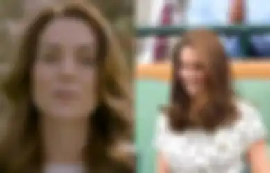 Kate Middleton Menderita Kanker, Awalnya Cuma Operasi Perut Kini Mulai Kemoterapi