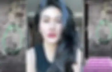 Benda Aneh Sepanjang 10 Cm Bersarang di Pinggul Stevie Agnecya, Dokter Buka Suara Soal Hasil Rontgen Mantan Istri Samuel Rizal