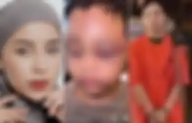 Terkuak Motif Pengasuh IPS Aniaya Anak Selebgram Aghnia Punjabi hingga Lebam Parah