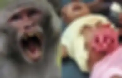 Bayi 2 Bulan di Lebak Banten Luka Parah Akibat Diserang Monyet Liar, Perut Robek hingga Usus Keluar