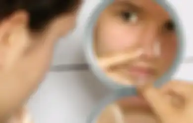 5 Tips Ampuh Atasi Komedo yang Membandel. Wajib Tahu!