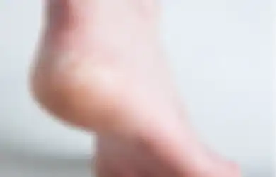 Ketahui, 6 Penyebab Tumit Kaki Kering dan Pecah-pecah, Yuk Hindari