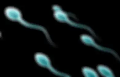 Sperma Kosong, Kondisi Tak Adanya Sperma saat Ejakulasi