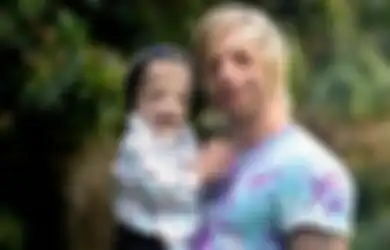 Jono Lancaster Jadi Sosok Inspiratif Berkat Wajahnya yang Buruk Rupa Akibat  Sindrom Treacher Collins