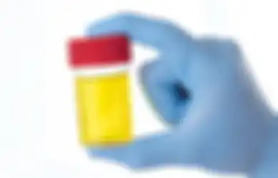 Urine Berbau Aneh? Kemungkinan 7 Hal Ini Gara-Garanya