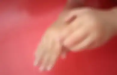 Hati-hati, Alergi Obat Bisa Sebabkan Kematian