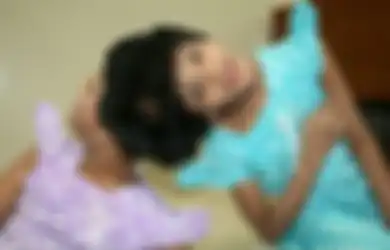 Tidak Sanggup Menghidupi, Anak Kembar Siam Ini Ditinggalkan Kedua Orangtuanya di Rumah Sakit