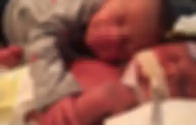 Mengharukan, Bayi Ini Memeluk Kembarannya untuk Terakhir Kalinya