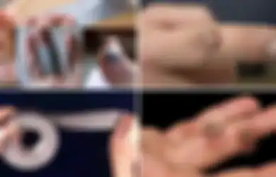 Wow! Cukup Dengan Lakban Kutil di Kulit Anda Akan Hilang, Bisa Dicoba Sekarang Juga 