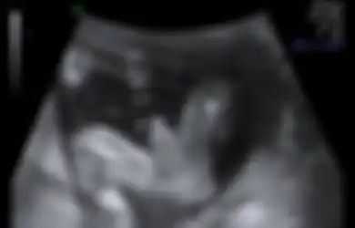 Janin pun Bisa Ereksi, Salah Satu Fakta tentang Penis yang Jarang Diketahui