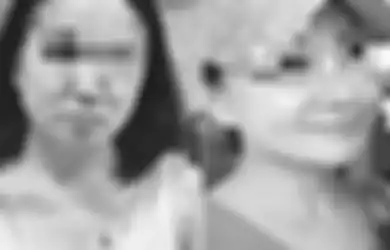 Gagal Menikah Karena Wajahnya Dianggap Jelek, Wanita Ini Lantas Operasi Plastik, Sekarang Lihat Hasilnya