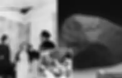 Sedang Satai di Sofa Depan Rumahnya, Wanita Ini Dihantam Batu Hitam Raksasa yang Jatuh Dari Langit, Alami Luka Lebam hingga Gagal Ginjal Usai Ditabrak Asteroid