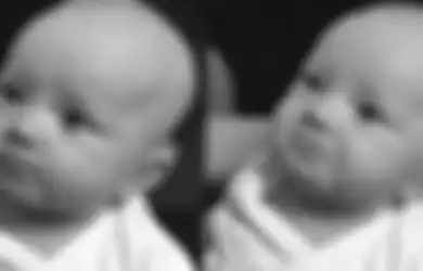 Menyentuh Hati, Bayi Tuli Ini Menahan Tangis ketika Mendengar Suara Ibu untuk Pertama Kalinya dengan Alat Bantu Dengar