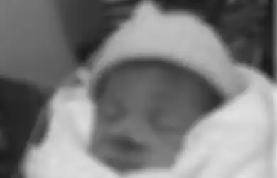 Lahir secara Caesar, Bayi Ini Diduga Terkena Sayatan Pisau Bedah dan Menjadi Cacat