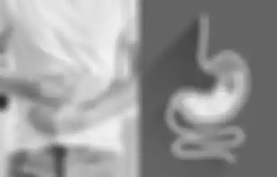 Pernah Menjangkiti Siapapun, Penyakit Lambung Ternyata Bisa Lebih Mematikan dari Kanker, Hindari 4 Makanan Ini Demi Kesehatan Perut 