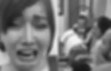 Kepalanya Pernah Dibelah, Lucinta Luna Ngaku Harus Minum Pereda Nyeri Gara-gara Keputusannya Cangkok Rambut, Tahan Sakit Sampai Alami Insomnia Berat