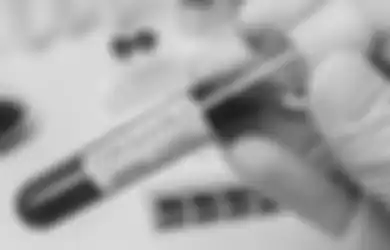 Cukup 2 Minggu, Pria Ini Dinyatakan Sembuh dari Virus Corona, Tim Medis China Sebut Ramuan Sederhana Ini Bisa Bersihkan Paru-paru dari Covid-19