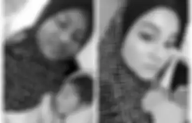 Beda 180 Derajat! Sebelumnya Miliki Wajah Putih Mulus, Kulit Perempuan Ini Berubah Gelap Hingga Tak Bisa Dikenali Saat Hamil, Ternyata Hal Inilah yang Terjadi