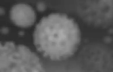 Dunia Sudah Kacau Balau Gara-gara Corona, Virus Baru Kembali Muncul dan Terancam Mewabah Satu Bumi, Ilmuwan Sebut Tak Ada Satu Pun Manusia yang Kebal dari Flu Mematikan Ini