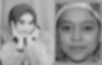 Masih Muda Sudah Permak Wajah, Perubahan Muka Lesti Kejora yang Mencolok Jadi Sorotan, Inul Daratista: Dulu Jelek Sekarang Cantik Itu Sah! 