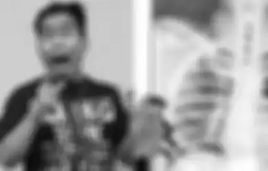 Mohon Keikhlasan Doa, Komedian Terkenal Ini Harus Terima Kenyataan Hidup dengan Satu Paru-paru, Begini Penampilan Terbaru Bopak Castello