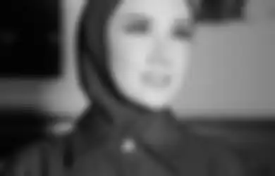 Kecantikannya Sukses Rebut Suami Rekan Duetnya Sendiri, Mulan Jameela Tiba-tiba Posting Wajah Berbintik Putih Penuh Obat, Istri Ahmad Dhani Keluhkan Alis dan Bibirnya