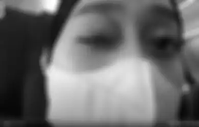 Terlihat di Kamera, Mata Lesti Kejora Tampak Lebam dan Berwarna Biru, Istri Rizky Billar Mengeluh Sakit hingga Ungkap Hal Ini