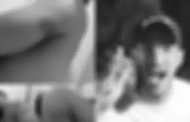 Antonio Dedola Pamerkan Foto Tubuh Penuh Luka Memar, Mantan Suami Siri Nikita Mirzani Ngaku di KDRT: Dia Menghukumku