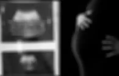 Viral Kisah Ibu Hamil Kehilangan Janin dalam Kandungan usai Tolong Nenek-nenek saat Magrib, Warganet Singgung Sosok Hantu Palasik