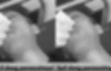 Viral Perawat Cewek Cengengesan saat Urus Pasien Korban Kecelakaan, Kepala Puskesmas Minta Maaf: Kami Berikan Sanksi