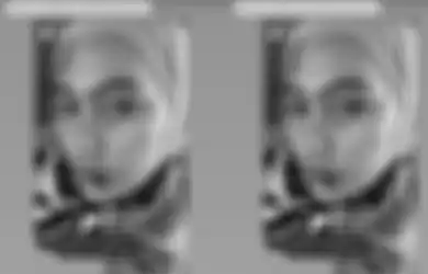Mulut dan Muka Ruam hingga Melepuh, Kartika Putri Berobat ke Singapura: InsyaAllah Gak Ada Penyakit Serius