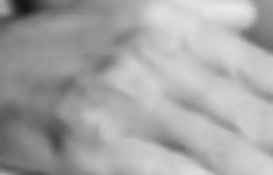 Eksim Itu Bukan Penyakit Gatal Karena Jamur, Bro. Ini 5 Hal Yang Perlu Kamu Ketahui 