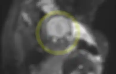 Bukannya Kaget, Pasangan Ini Justru Terpingkal-pingkal Setelah Melihat Foto MRI Anaknya