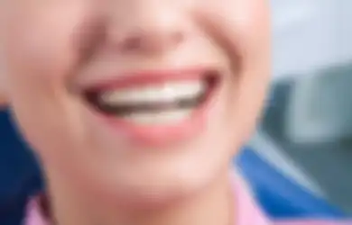 Tak Percaya Diri Miliki Karang Gigi? Inilah 7 Bahan Alami yang Bisa Menghilangkannya, Dijamin Langsung Rontok Tak Perlu ke Dokter!