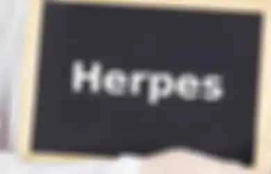 Kasihan, Bayi Berusia 3 Bulan Ini Terinfeksi Herpes Setelah Dicium Ibunya di Bibir Setiap Saat
