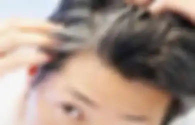 Uban Muncul Terlalu Dini? Pahami 7 Penyebab Utamanya Berikut