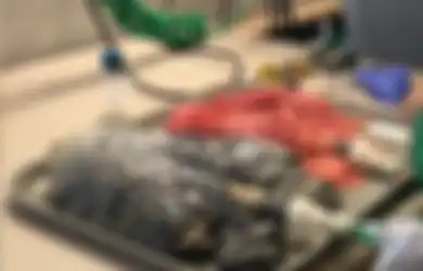 Pakai Vape Selama 2 Tahun, Paru-paru Pemuda 18 Tahun Ini Rusak: Bandingkan Dengan Kondisi Paru-paru Perokok Aktif Ini, Seram!