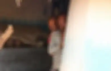 Derita Penyakit Langka, Dua Saudara Ini Dianggap ‘Anak Setan’ dan Dikucilkan